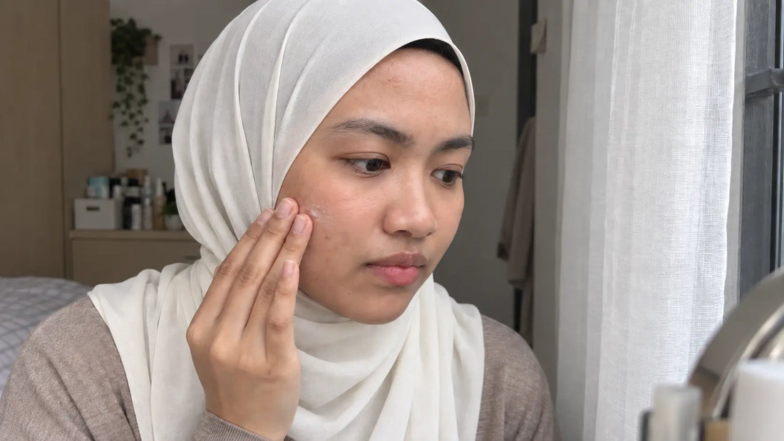 Malaysian woman with calm even-toned skin applying moisturiser to fade dark marks safely