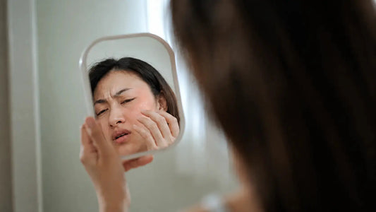 Why Does My Moisturiser Burn My Face? (No, Burning Doesn't Mean It's Working) dr.SK Skincare