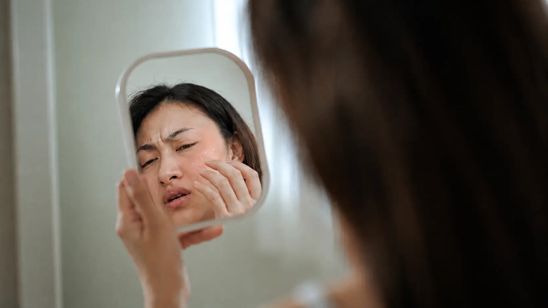 Why Does My Moisturiser Burn My Face? (No, Burning Doesn't Mean It's Working)