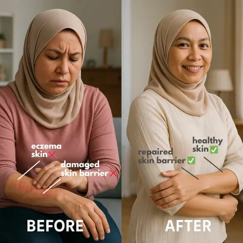 Before and after comparison of a woman's skin with eczema and a repaired skin barrier.