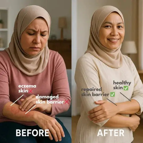Before and after comparison of a person with eczema and healthy skin, showing a repaired skin barrier.