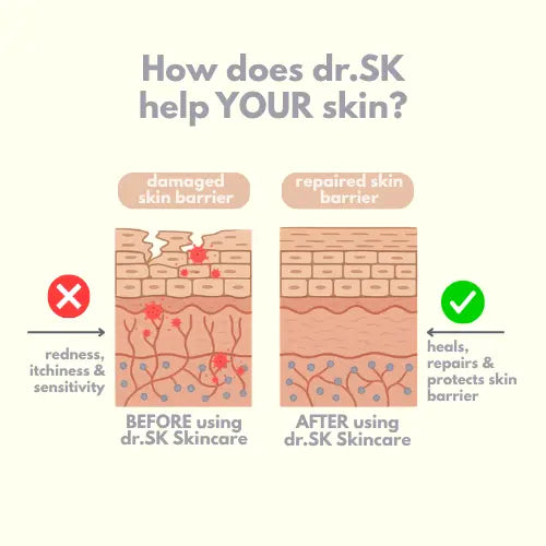 Diagram showing the effect of dr.SK skincare on a damaged skin barrier before and after use.